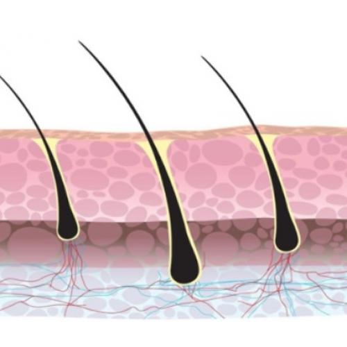 HaarStamcel Transplantatie Behandeling