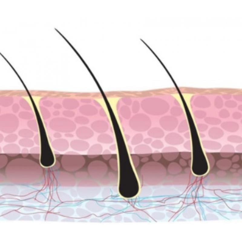 HaarStamcel Transplantatie Behandeling